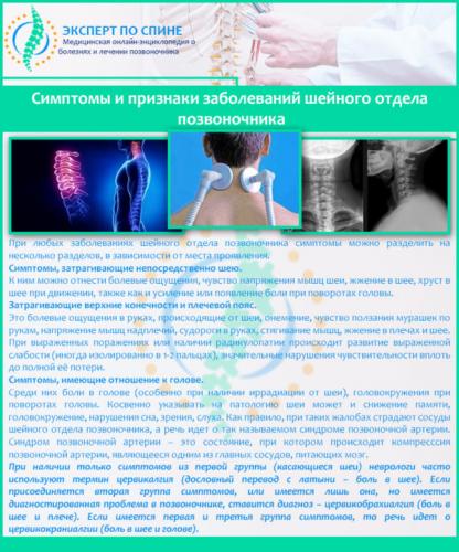 Симптомы и признаки заболеваний шейного отдела позвоночника