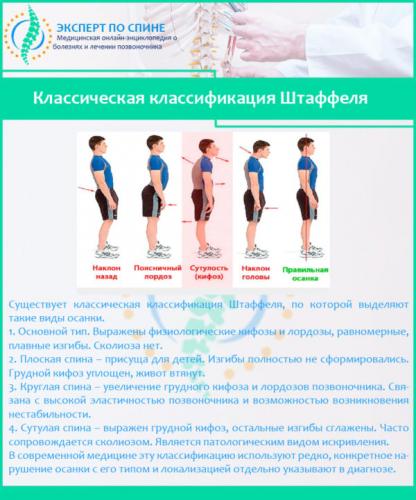 Классическая классификация Штаффеля