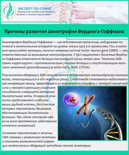 Причины развития амиотрофии Верднига-Гоффмана