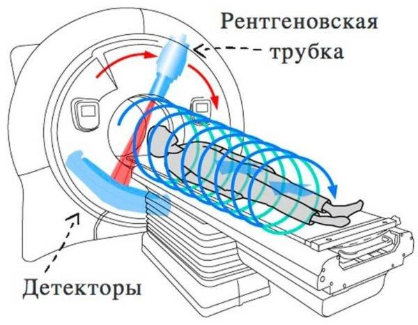 Компьютерная томография