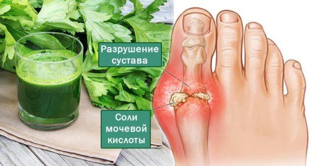 Вывести мочевую кислоту