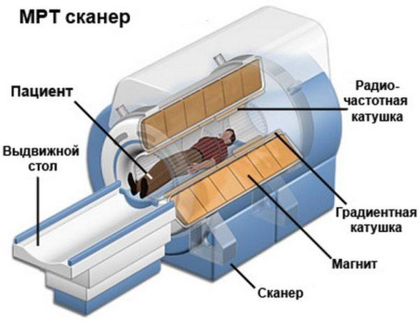 Как устроен аппарат МРТ